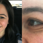 I Noticed Forehead Wrinkles In My 20s—And These Products Helped